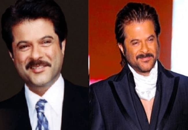 Anil Kapoor- Bollywood Celebrities Plastic Surgery