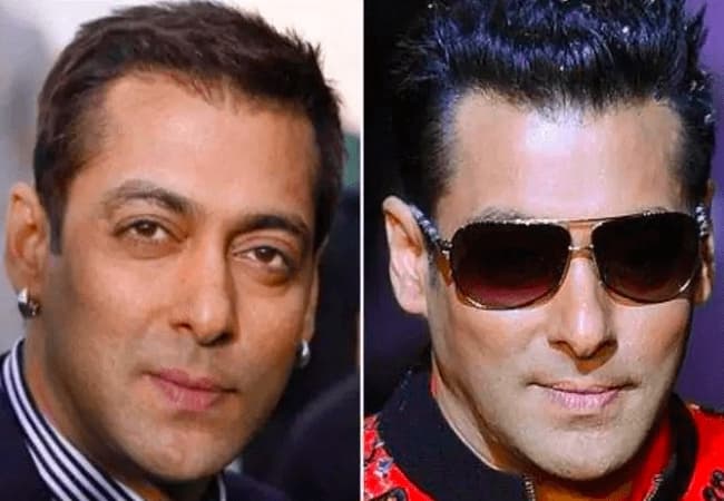 Salman Khan- Bollywood Celebrities Plastic Surgery