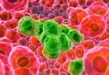 What Is Cancer and what all symptoms and treatment available to cure What Is Cancer