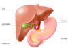 Pancreas Transplant for type 1 diabetic patients is reality in India Pancreas Transplant