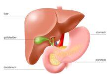 Pancreas Transplant for type 1 diabetic patients is reality in India Pancreas Transplant