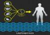 Leptospirosis Cause and Cure for you to be careful Leptospirosis Cause and Cure