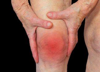 Arthritis and its forms to be learned by the common man Arthritis and its forms