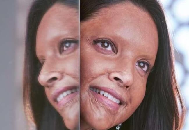 Chhapaak